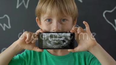 一个奶牙缺失的小男孩的特写镜头显示了他的x光牙齿图片。 儿童换牙的概念